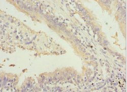 Invitrogen GABRR1 Polyclonal Antibody 100 μL; Unconjugated:Antibodies,