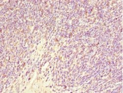 Invitrogen GABRR1 Polyclonal Antibody 100 μL; Unconjugated:Antibodies,