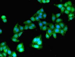 GBP2 Polyclonal Antibody, Invitrogen 100 &mu;g; Unconjugated:Antibodies,