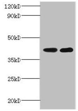 Invitrogen GLT8D2 Polyclonal Antibody 100 &mu;g; Unconjugated:Antibodies,