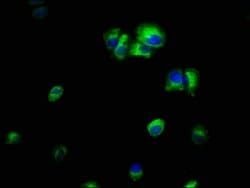 Invitrogen ILK Polyclonal Antibody 100 μg; Unconjugated:Antibodies,