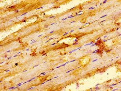 Invitrogen ILK Polyclonal Antibody 100 μg; Unconjugated:Antibodies,