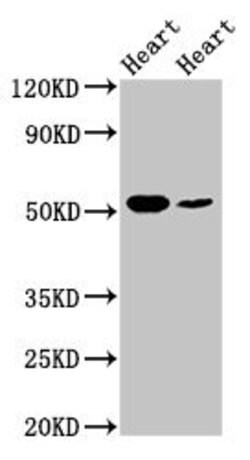 Invitrogen ILK Polyclonal Antibody 100 μg; Unconjugated:Antibodies,