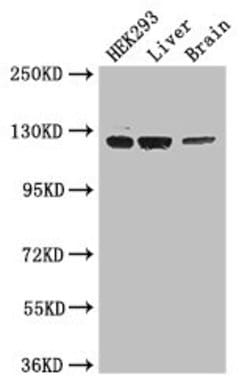 Invitrogen GUCY2C Polyclonal Antibody 100 &mu;g | Buy Online | Invitrogen&trade; | Fisher Scientific