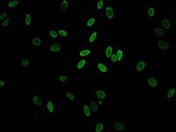 Invitrogen H2A.ZK11ac Polyclonal Antibody 100 μL; Unconjugated:Antibodies,