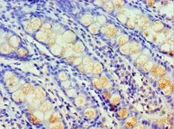 Invitrogen HARS Polyclonal Antibody 100 &mu;L; Unconjugated:Antibodies,