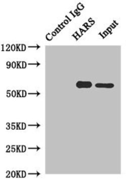 Invitrogen HARS Polyclonal Antibody 100 &mu;L; Unconjugated:Antibodies,