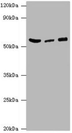 Invitrogen HARS Polyclonal Antibody 100 &mu;L; Unconjugated:Antibodies,