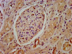 Invitrogen HIP1R Polyclonal Antibody 100 &mu;g; Unconjugated:Antibodies,