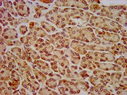 Invitrogen HIP1R Polyclonal Antibody 100 &mu;g; Unconjugated:Antibodies,