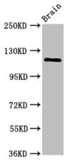 Invitrogen HIP1R Polyclonal Antibody 100 &mu;g; Unconjugated:Antibodies,