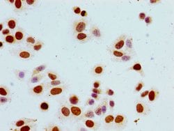 Invitrogen Phospho-Histone H1.5 (Ser17) Polyclonal Antibody 100 μL;