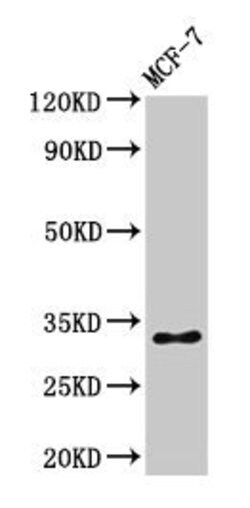 Invitrogen Phospho-Histone H1.5 (Ser17) Polyclonal Antibody 100 μL;