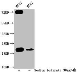 Invitrogen Formyl-Histone H1.2 (Lys109) Polyclonal Antibody 100 &mu;L;
