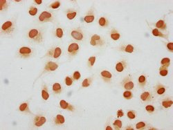 Invitrogen 2-hydroxyisobutyryl-Histone H1.2 (Lys109) Polyclonal Antibody