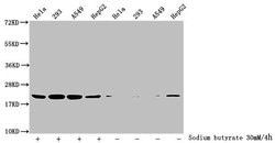 Invitrogen 2-hydroxyisobutyryl-Histone H1.2 (Lys109) Polyclonal Antibody