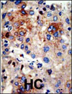 Invitrogen HDAC9 Polyclonal Antibody 400 &mu;L; Unconjugated:Anticorps,