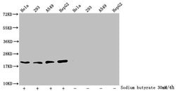 Invitrogen Acetyl-Histone H1.2 (Lys84) Polyclonal Antibody 100 &mu;L; Unconjugated:Antibodies,
