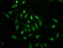 Invitrogen Formyl-Histone H1.2 (Lys96) Polyclonal Antibody 100 &mu;L; Unconjugated:Antikörper