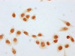 Invitrogen beta-hydroxybutyryl-Histone H1.3 (Lys106) Polyclonal Antibody