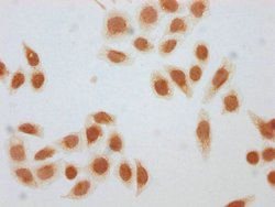 Invitrogen beta-hydroxybutyryl-Histone H1.3 (Lys75) Polyclonal Antibody