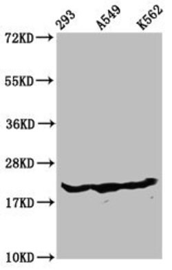 Invitrogen beta-hydroxybutyryl-Histone H1.3 (Lys75) Polyclonal Antibody