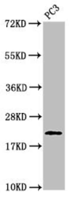 Invitrogen Phospho-Histone H1.3 (Thr146) Polyclonal Antibody 100 &mu;L;
