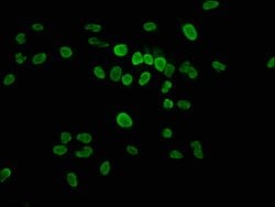Invitrogen Phospho-Histone H1.4 (Thr17) Polyclonal Antibody 100 &mu;L;