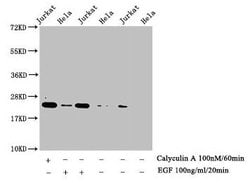 Invitrogen Phospho-Histone H1.4 (Thr17) Polyclonal Antibody 100 &mu;L;