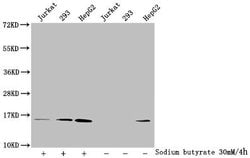 Invitrogen Acetyl-Histone Macro-H2A.1 (Lys9) Polyclonal Antibody 100 &mu;L;