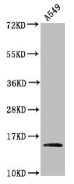 Invitrogen 2-hydroxyisobutyryl-Histone Macro-H2A.1 (Lys9) Polyclonal Antibody