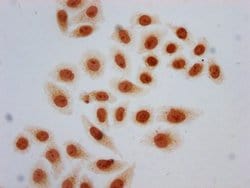 Invitrogen Acetyl-Histone Macro-H2A.1 (Lys13) Polyclonal Antibody 100 &mu;L;