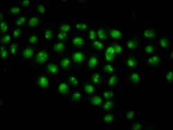 Invitrogen Acetyl-Histone Macro-H2A.1 (Lys13) Polyclonal Antibody 100 &mu;L;