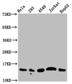 Invitrogen Acetyl-Histone Macro-H2A.1 (Lys13) Polyclonal Antibody 100 &mu;L;
