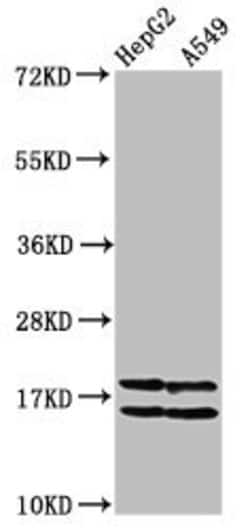 Invitrogen Acetyl-Histone Macro-H2A.1 (Lys36) Polyclonal Antibody 100 &mu;L;