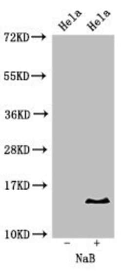 Invitrogen H2BK16ac Polyclonal Antibody 100 &mu;L | Buy Online | Invitrogen&trade; | Fisher Scientific