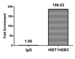 Invitrogen H2BK116ac Polyclonal Antibody 100 &mu;L; Unconjugated:Antibodies,