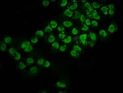 Invitrogen H2BK116ac Polyclonal Antibody 100 &mu;L; Unconjugated:Antibodies,