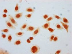 Invitrogen 2-hydroxyisobutyryl-Histone H2B (Lys24) Polyclonal Antibody