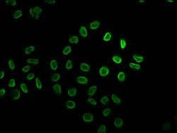 Invitrogen 2-hydroxyisobutyryl-Histone H2B (Lys34) Polyclonal Antibody