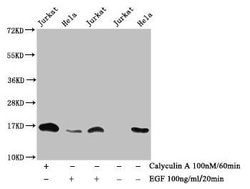 Phospho-Histone H3 (Thr3) Polyclonal Antibody:Antibodies, Polyclonal
