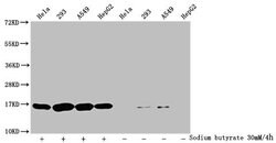 Butyryl-Histone H3 (Lys9) Polyclonal Antibody:Antibodies, Polyclonal