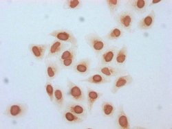 Invitrogen beta-hydroxybutyryl-Histone H3 (Lys18) Polyclonal Antibody 100