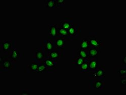 Invitrogen beta-hydroxybutyryl-Histone H3 (Lys18) Polyclonal Antibody 100