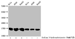 Invitrogen beta-hydroxybutyryl-Histone H3 (Lys18) Polyclonal Antibody 100