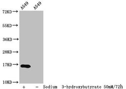 Invitrogen beta-hydroxybutyryl-Histone H3 (Lys23) Polyclonal Antibody 100