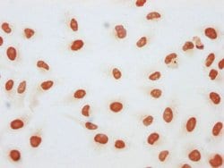 beta-hydroxybutyryl-Histone H3 (Lys27) Polyclonal Antibody:Antibodies,