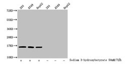 beta-hydroxybutyryl-Histone H3 (Lys27) Polyclonal Antibody:Antibodies,