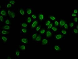 Invitrogen 2-hydroxyisobutyryl-Histone H3 (Lys27) Polyclonal Antibody 100