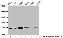 Invitrogen 2-hydroxyisobutyryl-Histone H3 (Lys27) Polyclonal Antibody 100